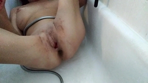 Lizzy Yum - Lizzy Yum Post Op snatch And Verification